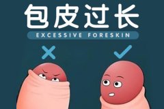 固原包皮过长的症状？