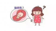 无痛人流手术最佳时间？”
